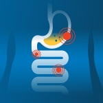 ГастроCheck-up: пройди обследование органов пищеварения со скидкой